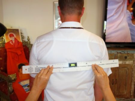 Schulterblätter vor der Begradigung